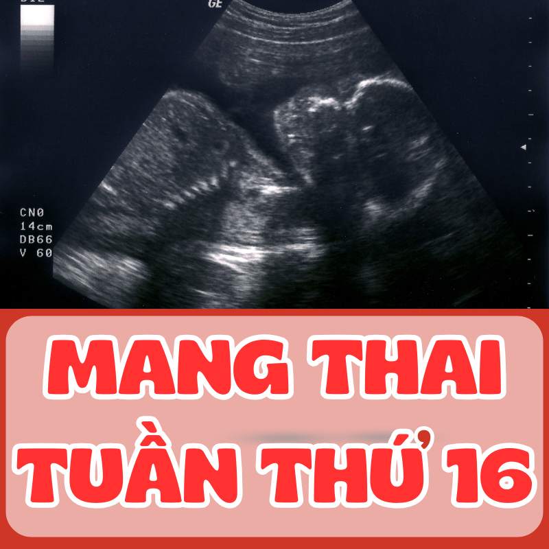 Siêu âm thai tuần thứ 16